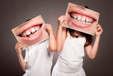 Fluorosis dental: causa y tratamientos